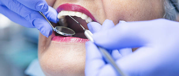 Best Emergency Cosmetic Dentistry in West University Place, TX
